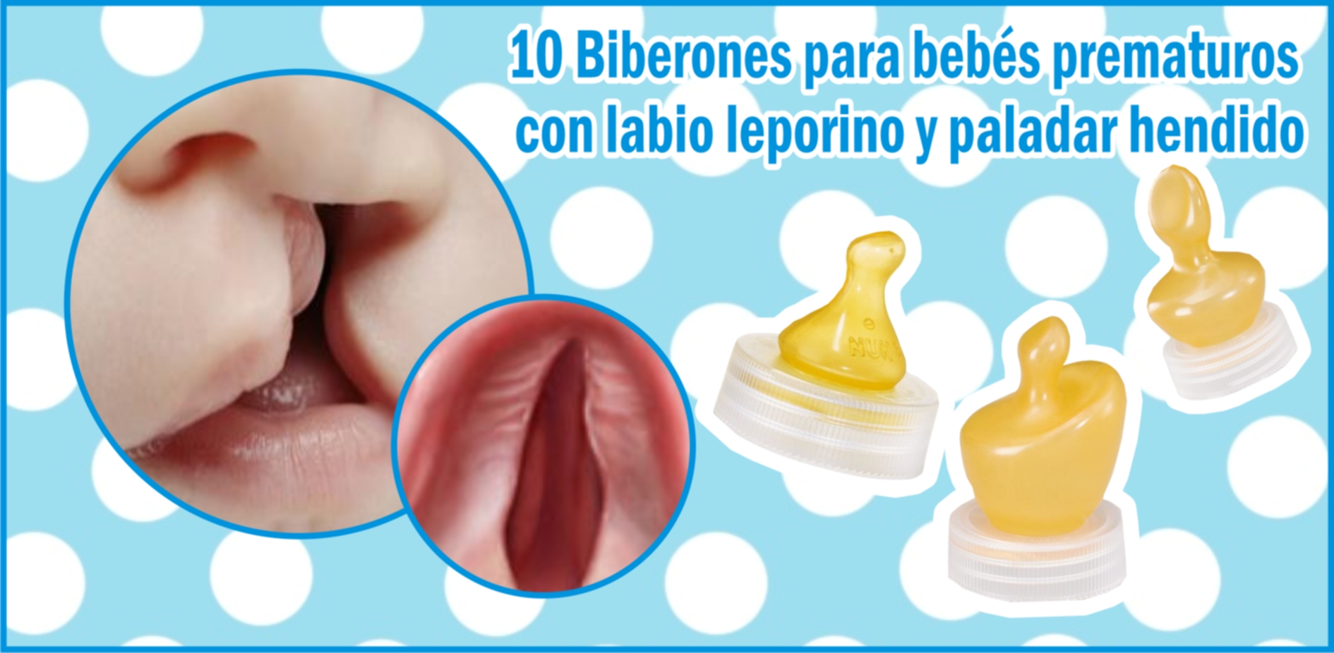 fuegos artificiales Tesauro té 10 biberones para bebés con labio leporino y paladar hendido