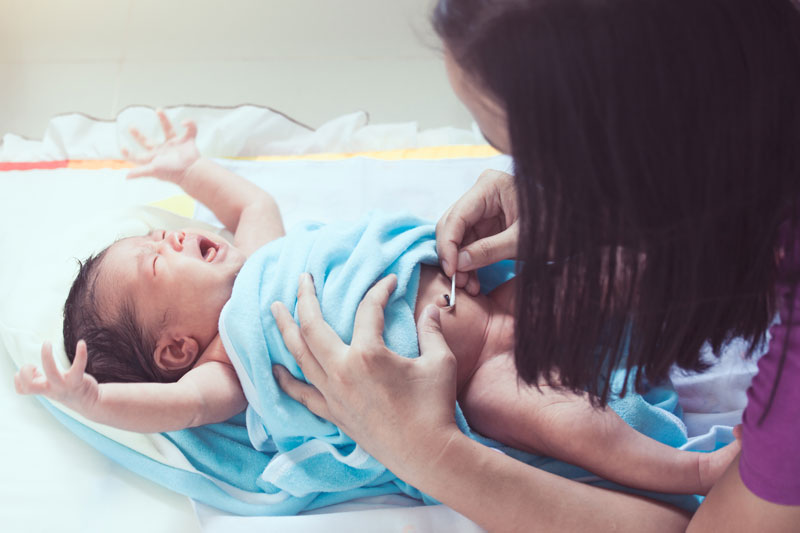 Los mejores consejos para curar el ombligo del recién nacido.